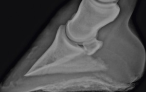 foot bone